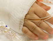 Perioperatief vochtbeleid en transfusiebeleid bij kinderen
